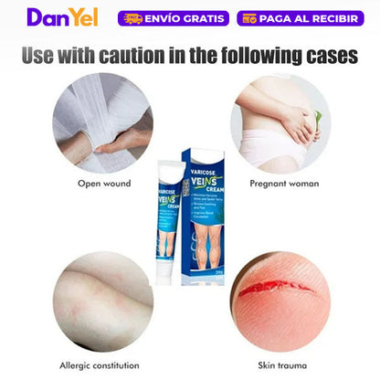 Crema para Aliviar las Varices
