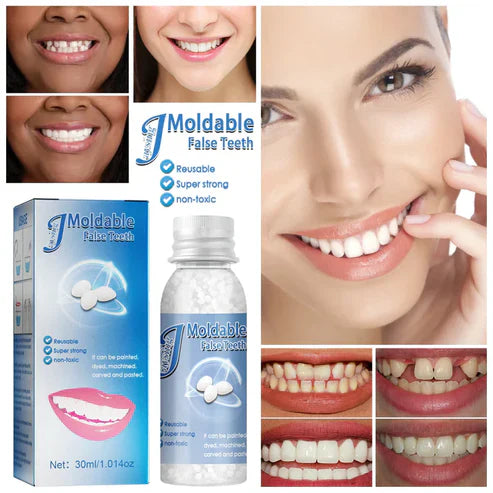 Sonrisa Perfecta Al Instante | Repara Tu Sonrisa | Implante De Diente
