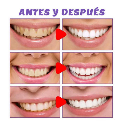 Crema Dental Blanqueadora
