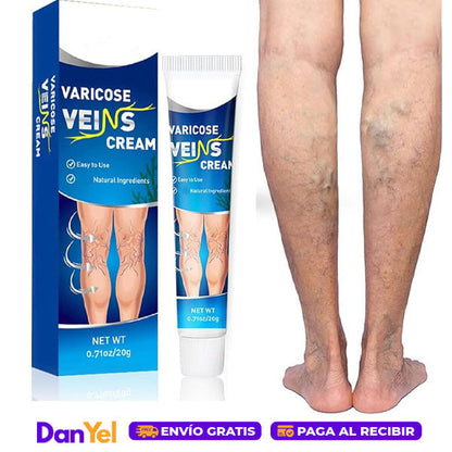 Crema para Aliviar las Varices