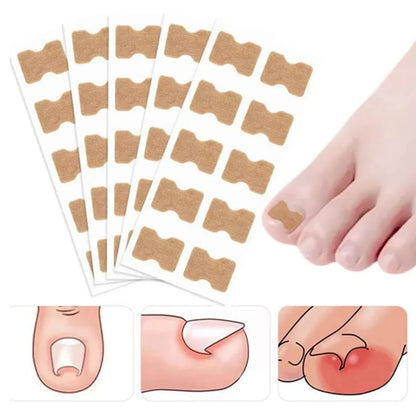 Parche Corrector de Uñas | 100 Parches  | 2x1