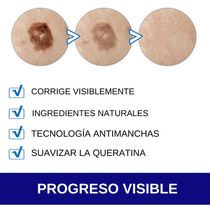 Crema para Eliminas Verrugas