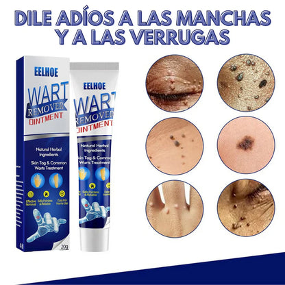 Crema para Eliminas Verrugas