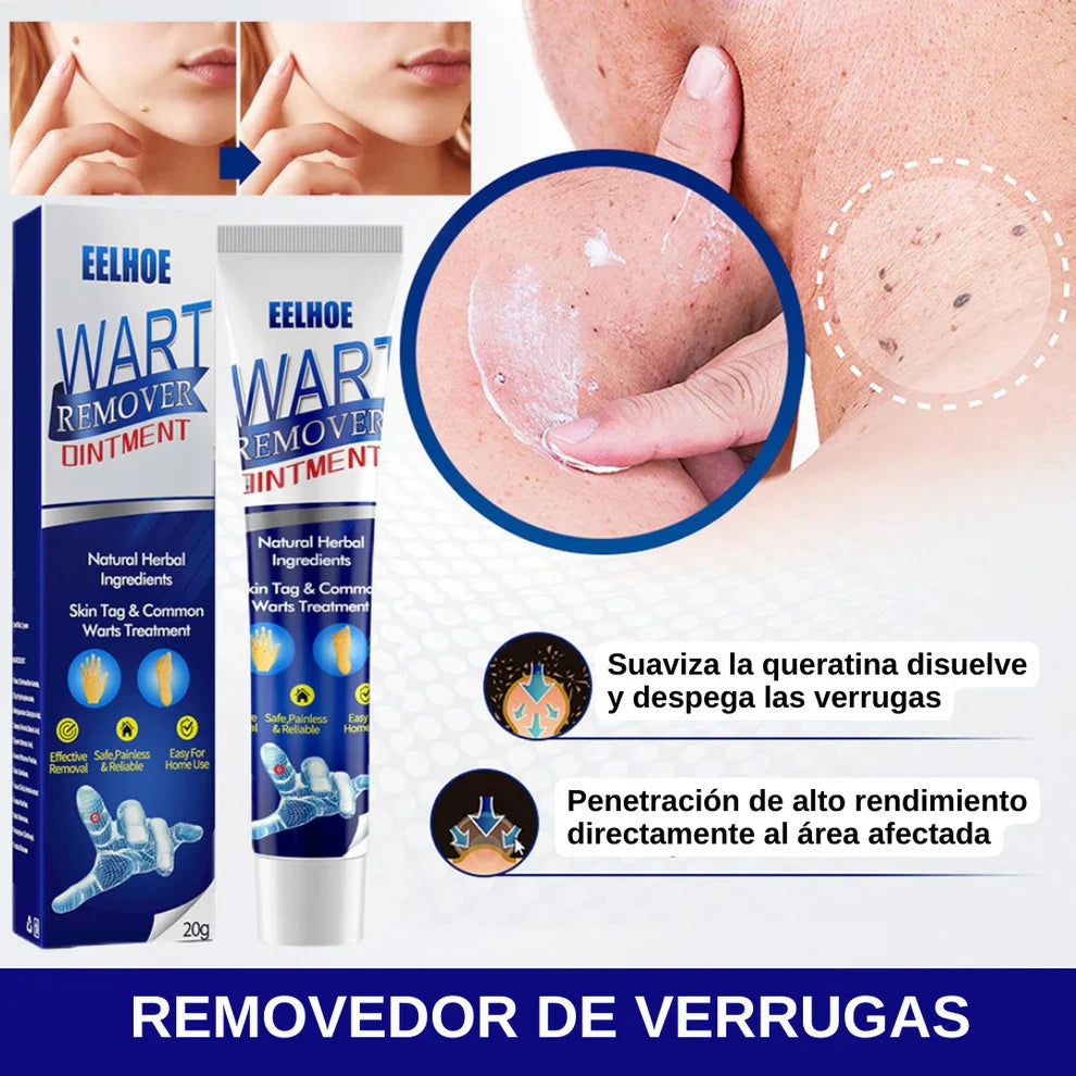 Crema para Eliminas Verrugas