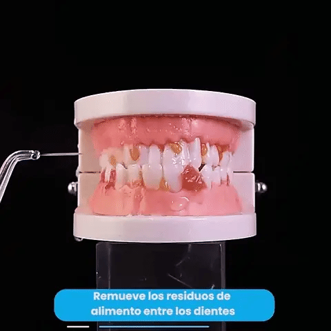 Irrigador Bucal