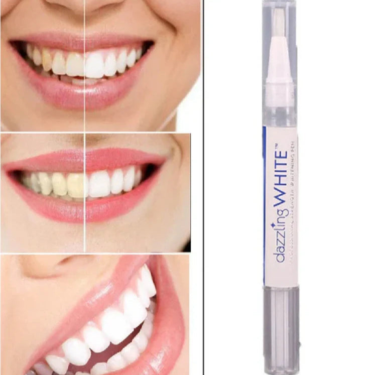 Lápiz Blanqueador de Dientes. Sonrisa Radiante 4x1
