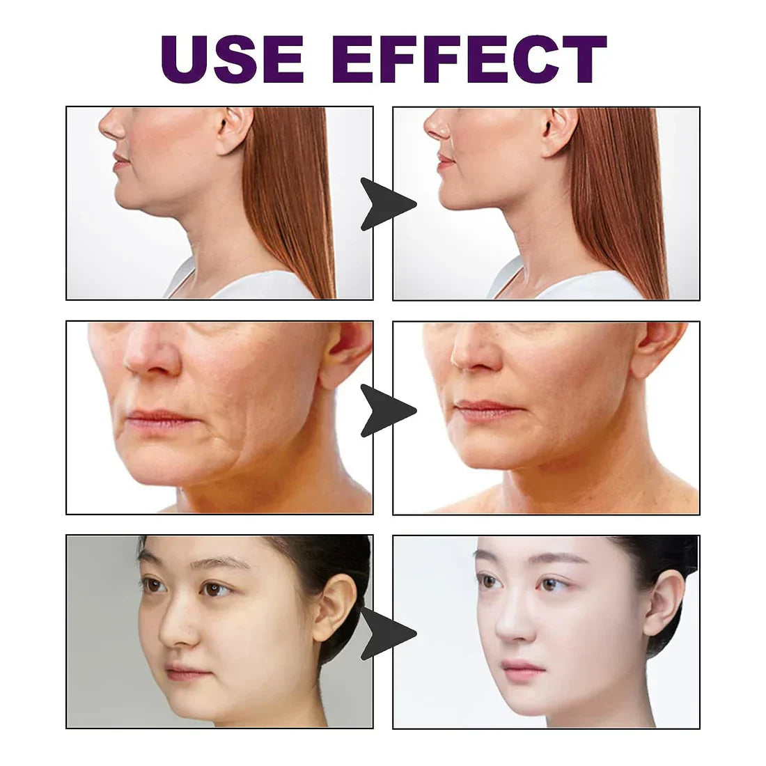 Cinta Lifting Iinvisible | Rejuvenece Tu Rostro