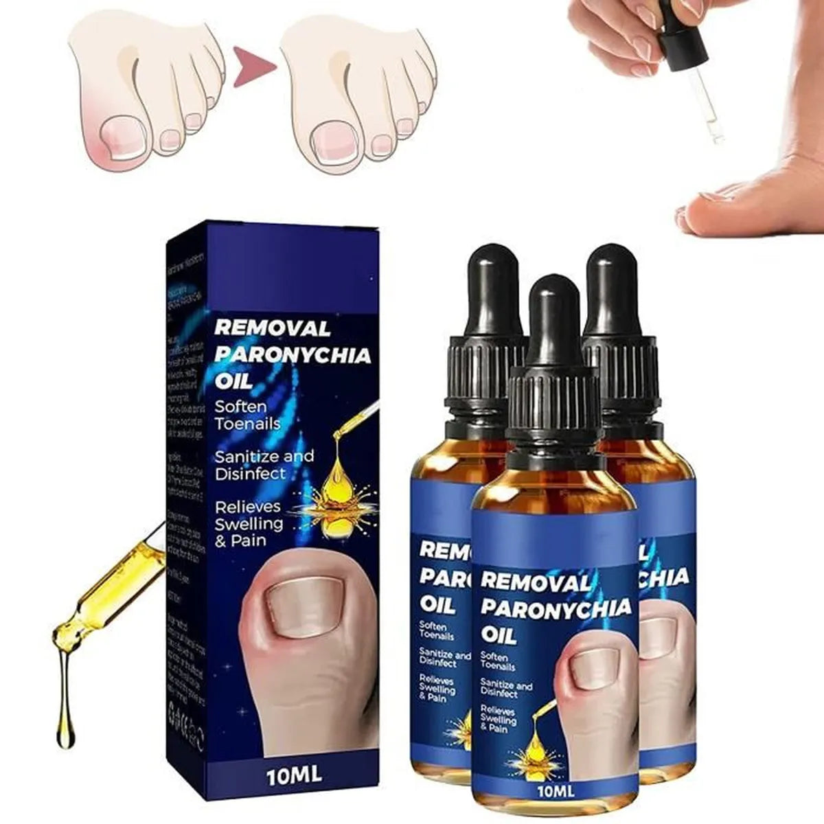 Dile Adiós a los Hongos | Aceite Milagroso 3X1